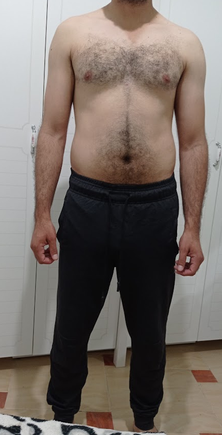 transformation