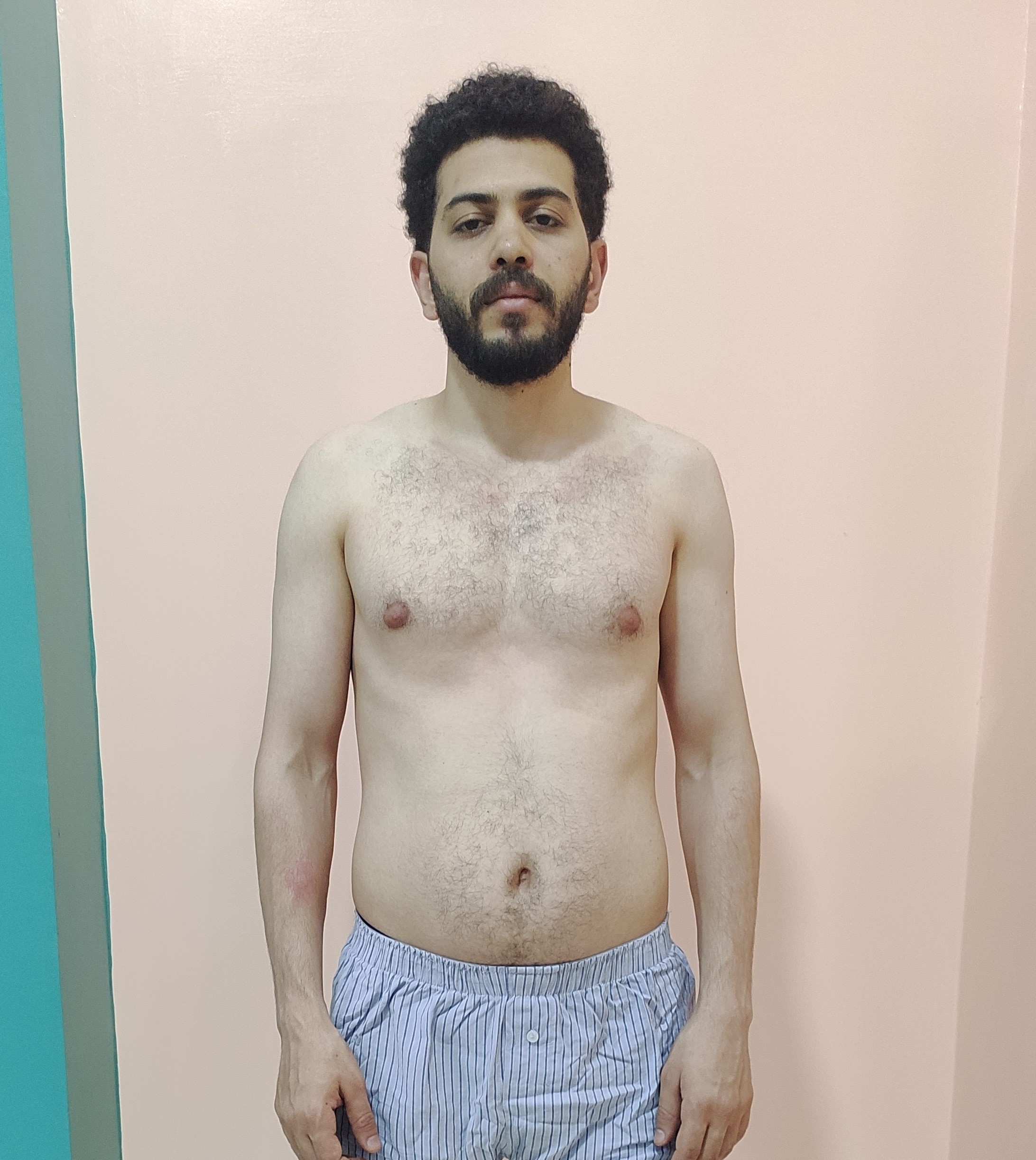 transformation